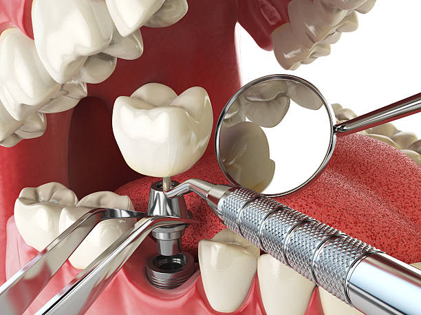 Best Emergency Root Canal Therapy in Belvedere Park, GA